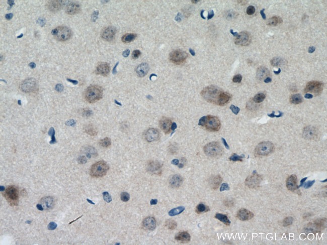 TESC Antibody in Immunohistochemistry (Paraffin) (IHC (P))