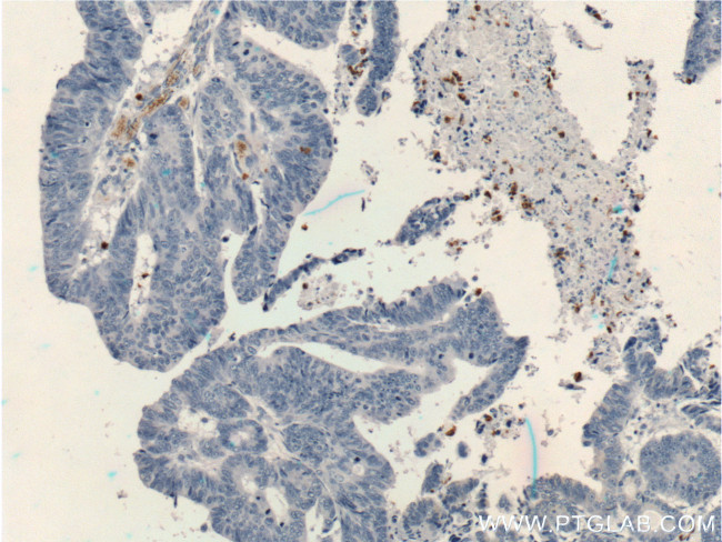 TESC Antibody in Immunohistochemistry (Paraffin) (IHC (P))