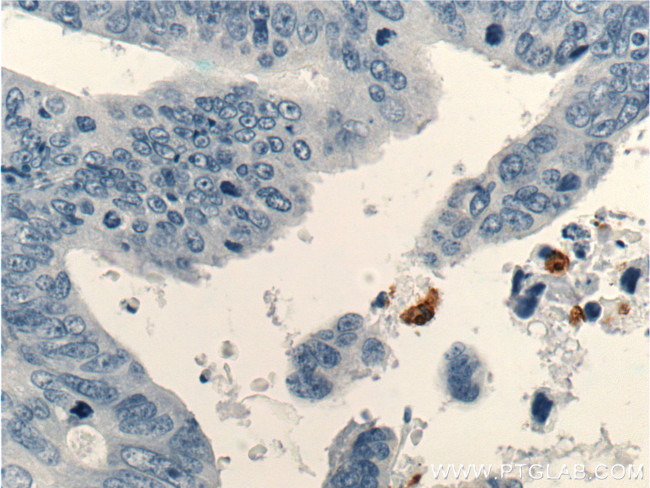 TESC Antibody in Immunohistochemistry (Paraffin) (IHC (P))