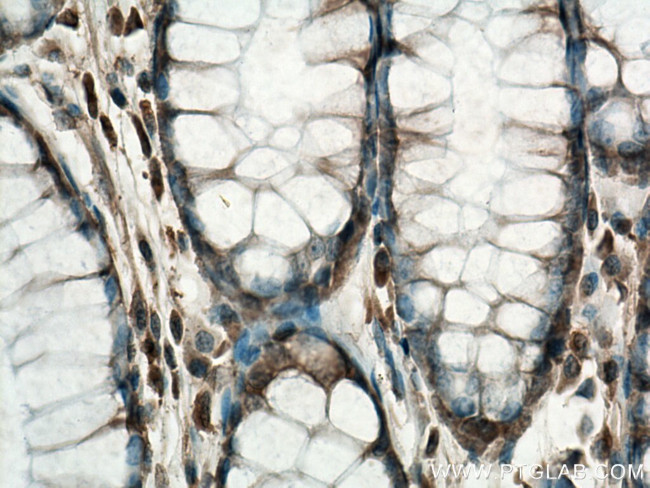 TESC Antibody in Immunohistochemistry (Paraffin) (IHC (P))