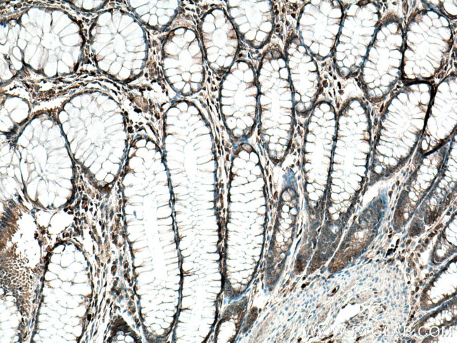 TESC Antibody in Immunohistochemistry (Paraffin) (IHC (P))