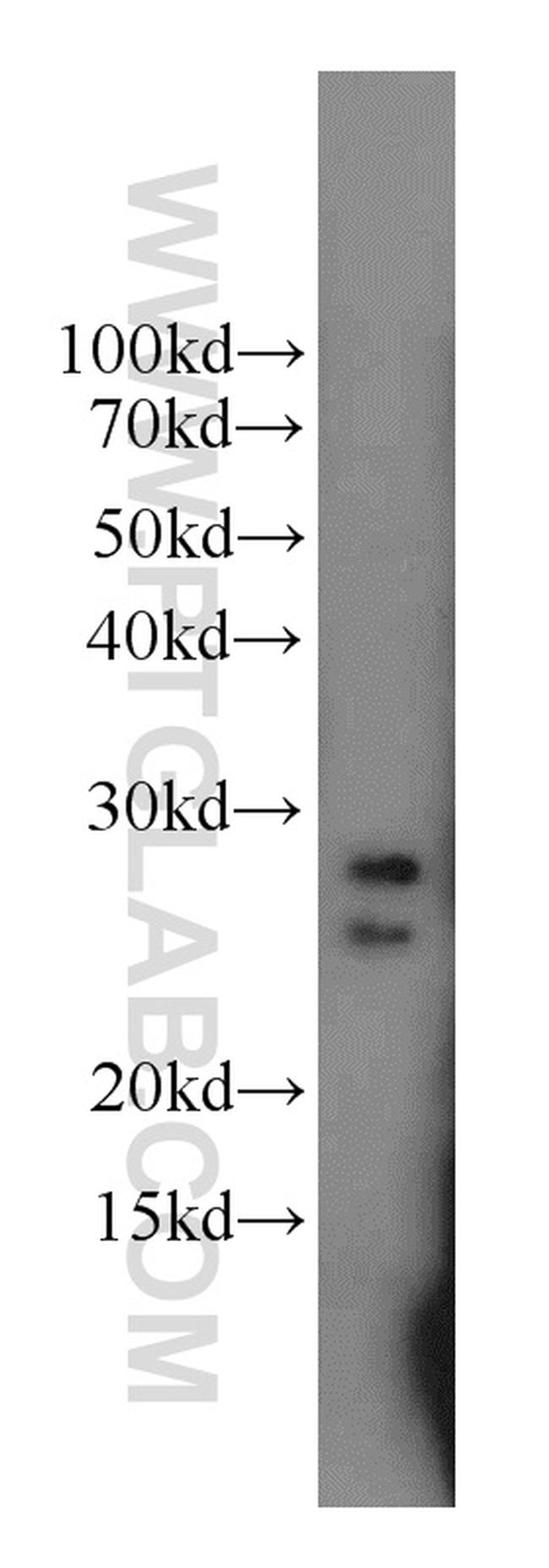 TESC Antibody in Western Blot (WB)