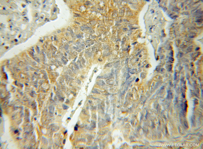 SH3BP5 Antibody in Immunohistochemistry (Paraffin) (IHC (P))