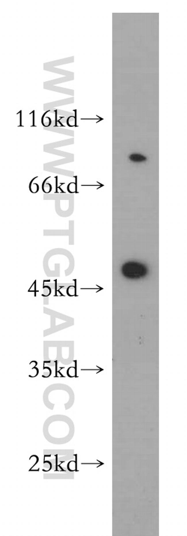 SH3BP5 Antibody in Western Blot (WB)