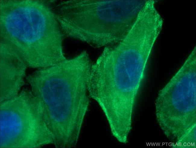 MYH9 Antibody in Immunocytochemistry (ICC/IF)