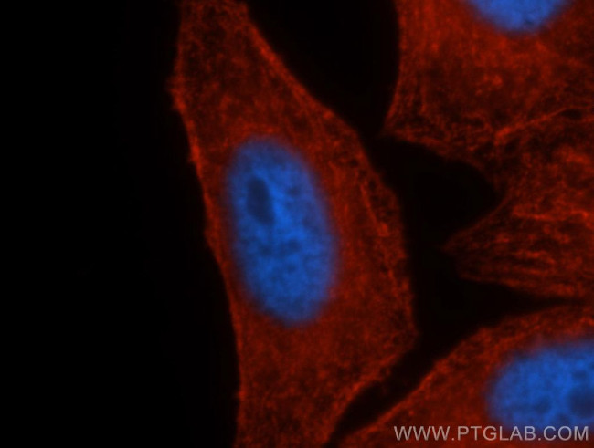 MYH9 Antibody in Immunocytochemistry (ICC/IF)