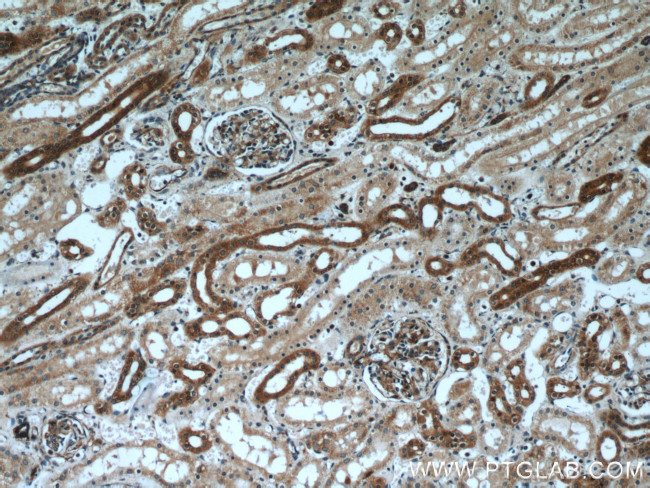 MYH9 Antibody in Immunohistochemistry (Paraffin) (IHC (P))