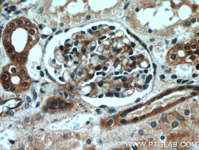 MYH9 Antibody in Immunohistochemistry (Paraffin) (IHC (P))