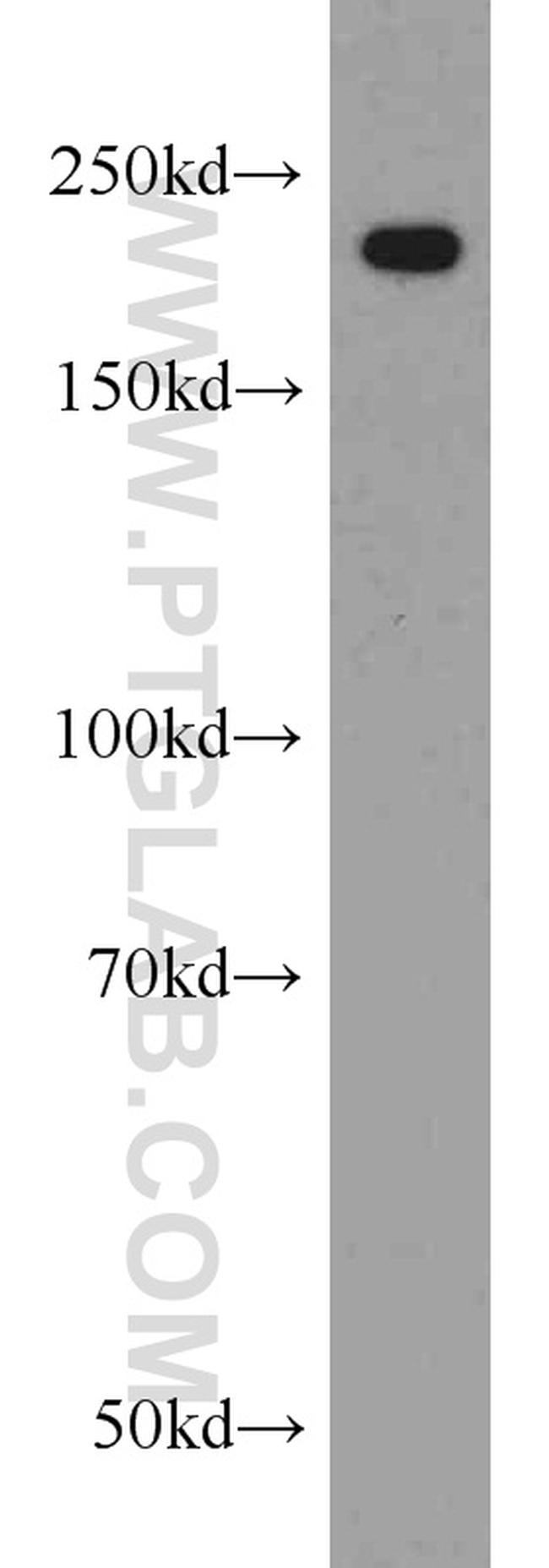 MYH9 Antibody in Western Blot (WB)