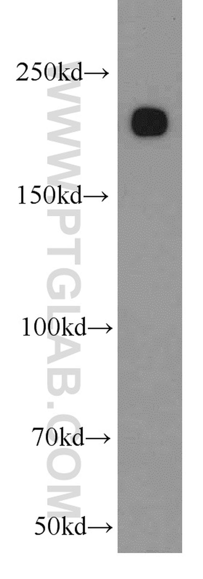 MYH9 Antibody in Western Blot (WB)