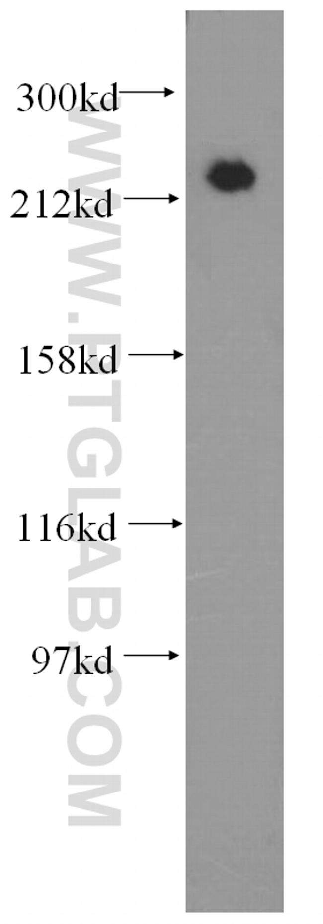 MYH9 Antibody in Western Blot (WB)