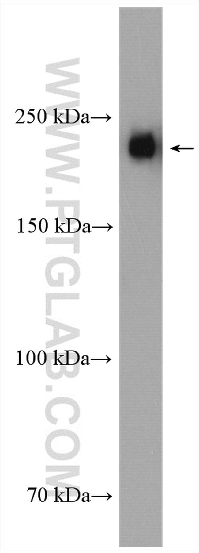 MYH9 Antibody in Western Blot (WB)