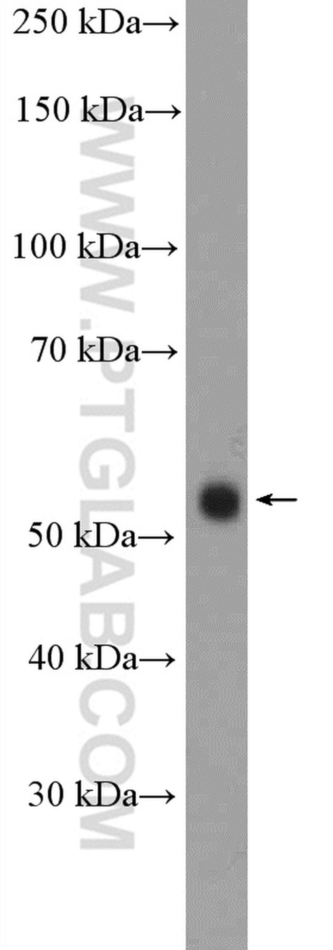 RXRG Antibody in Western Blot (WB)