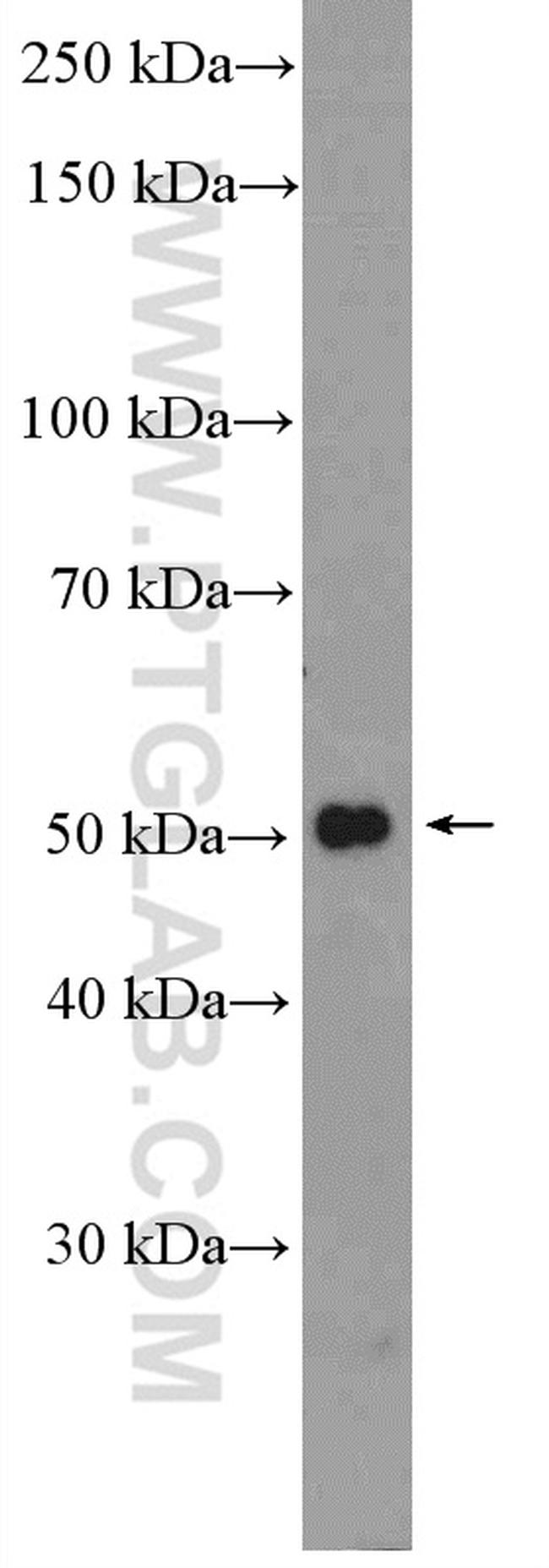 RXRG Antibody in Western Blot (WB)