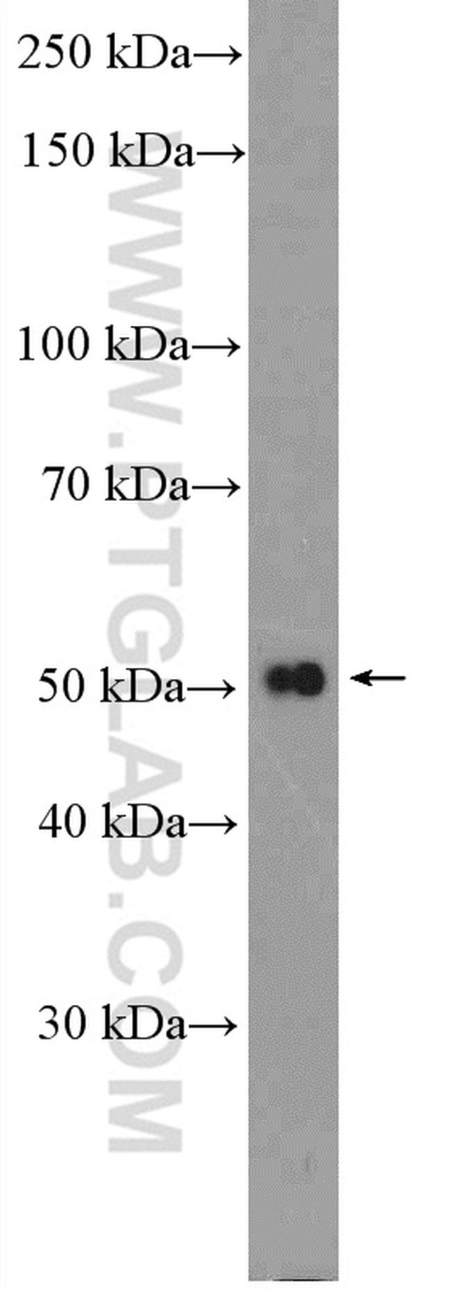 RXRG Antibody in Western Blot (WB)