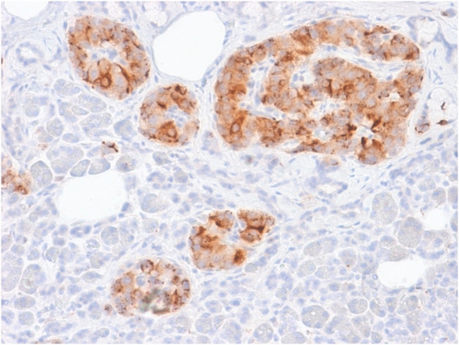 Chromogranin A/CHGA Antibody in Immunohistochemistry (Paraffin) (IHC (P))