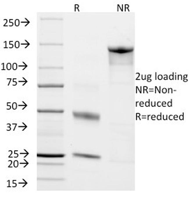 Chromogranin A/CHGA Antibody in SDS-PAGE (SDS-PAGE)