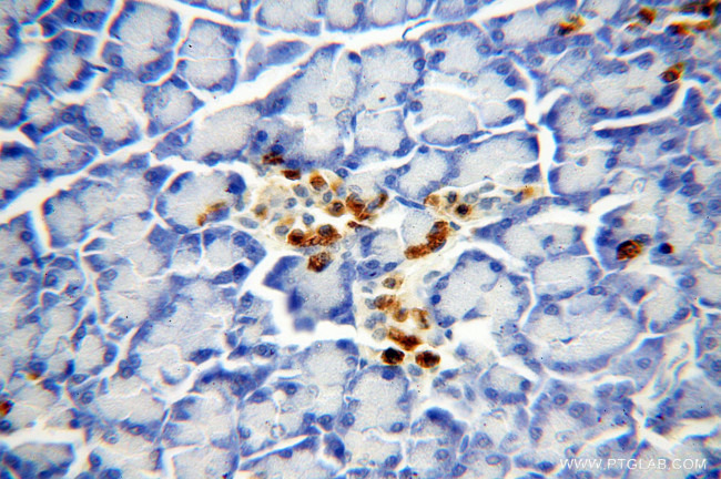 COG3 Antibody in Immunohistochemistry (Paraffin) (IHC (P))