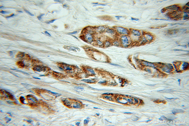 COG3 Antibody in Immunohistochemistry (Paraffin) (IHC (P))