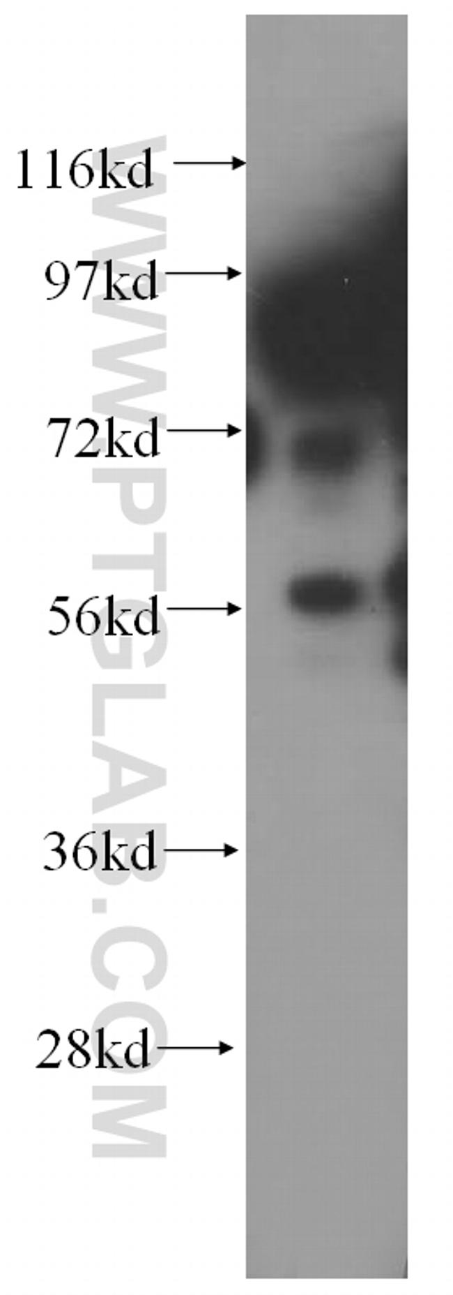 COG3 Antibody in Western Blot (WB)