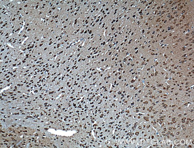 Dysbindin Antibody in Immunohistochemistry (Paraffin) (IHC (P))