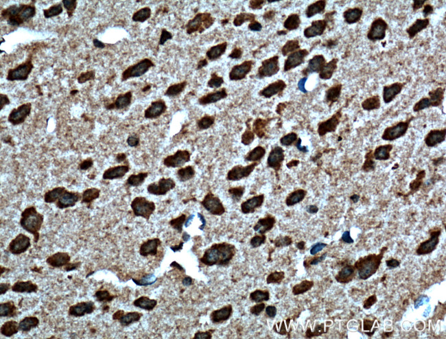 Dysbindin Antibody in Immunohistochemistry (Paraffin) (IHC (P))