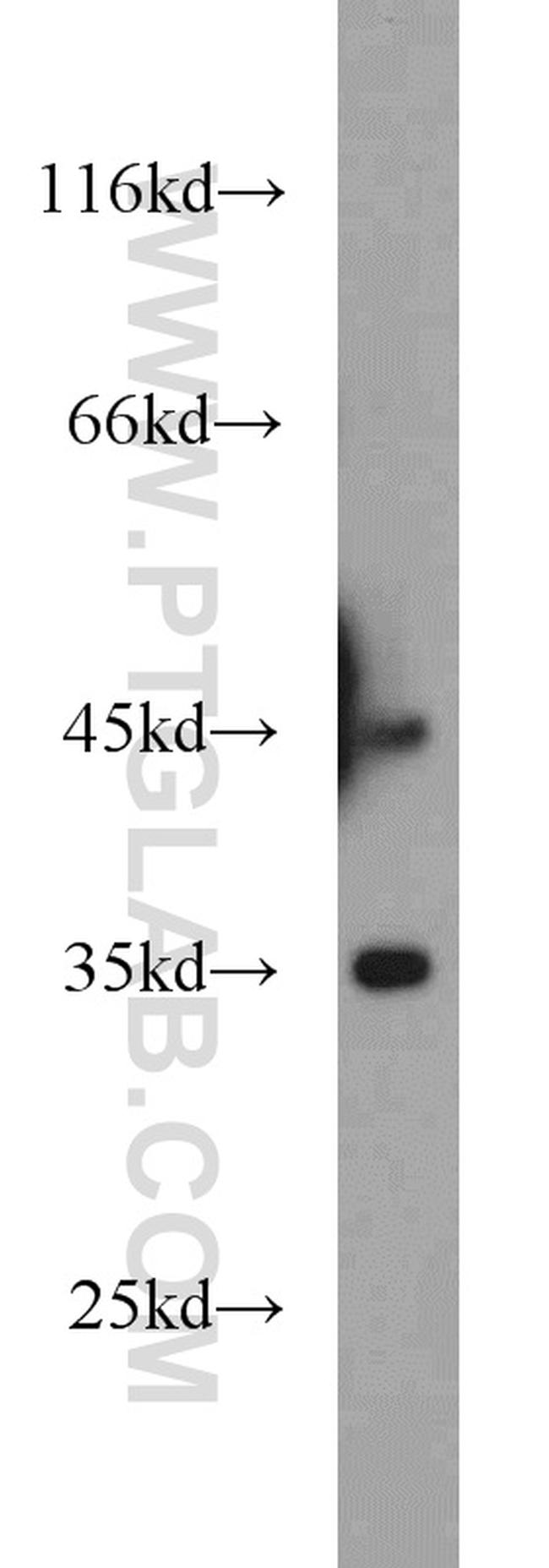 Dysbindin Antibody in Western Blot (WB)