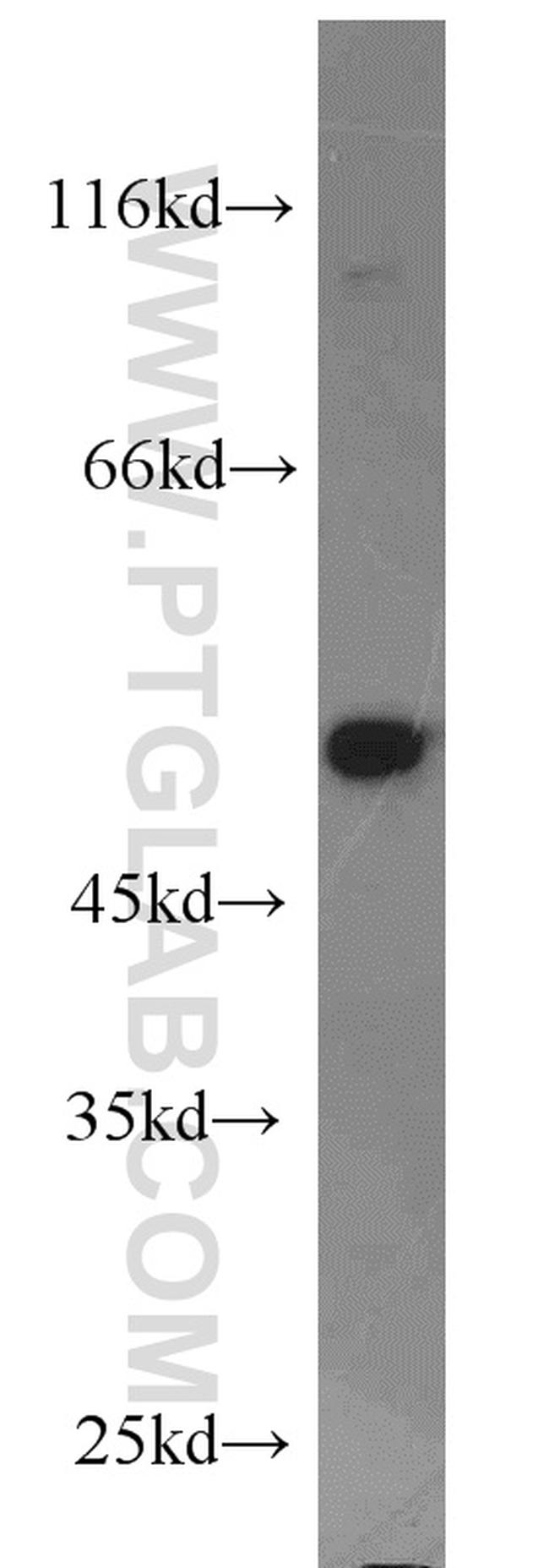 Dysbindin Antibody in Western Blot (WB)