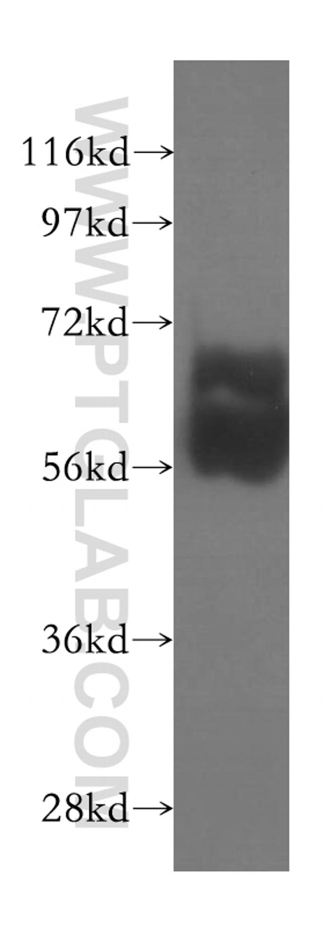 TBX22 Antibody in Western Blot (WB)