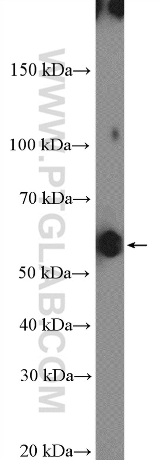 TBX22 Antibody in Western Blot (WB)