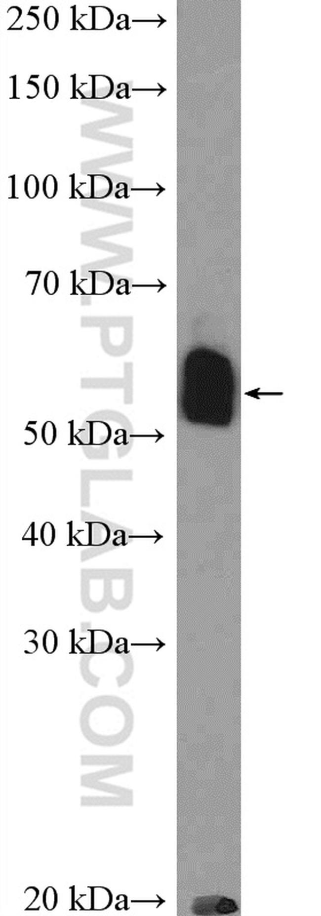 TBX22 Antibody in Western Blot (WB)