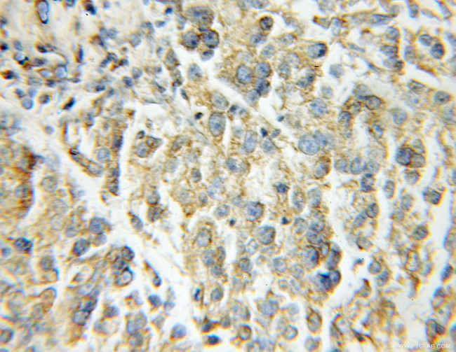 Aconitase 2 Antibody in Immunohistochemistry (Paraffin) (IHC (P))