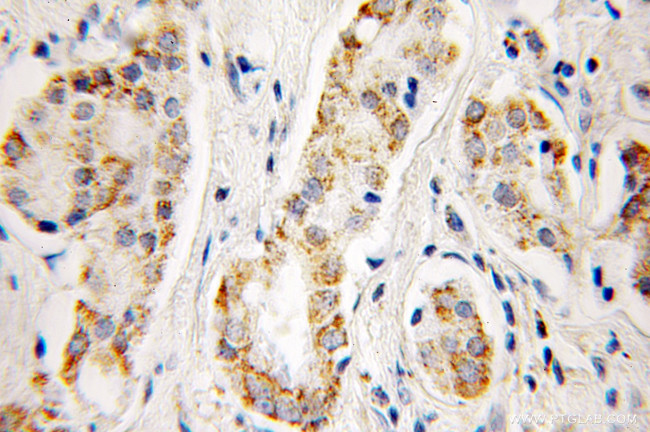 Aconitase 2 Antibody in Immunohistochemistry (Paraffin) (IHC (P))