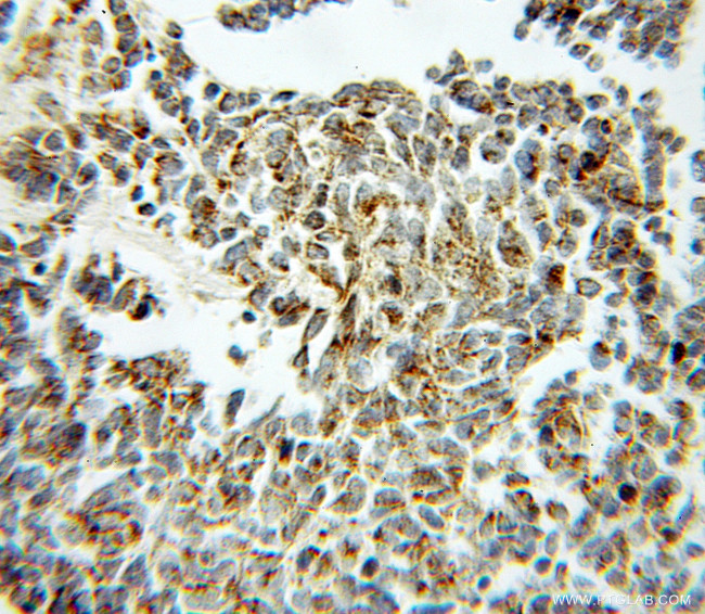 Aconitase 2 Antibody in Immunohistochemistry (Paraffin) (IHC (P))