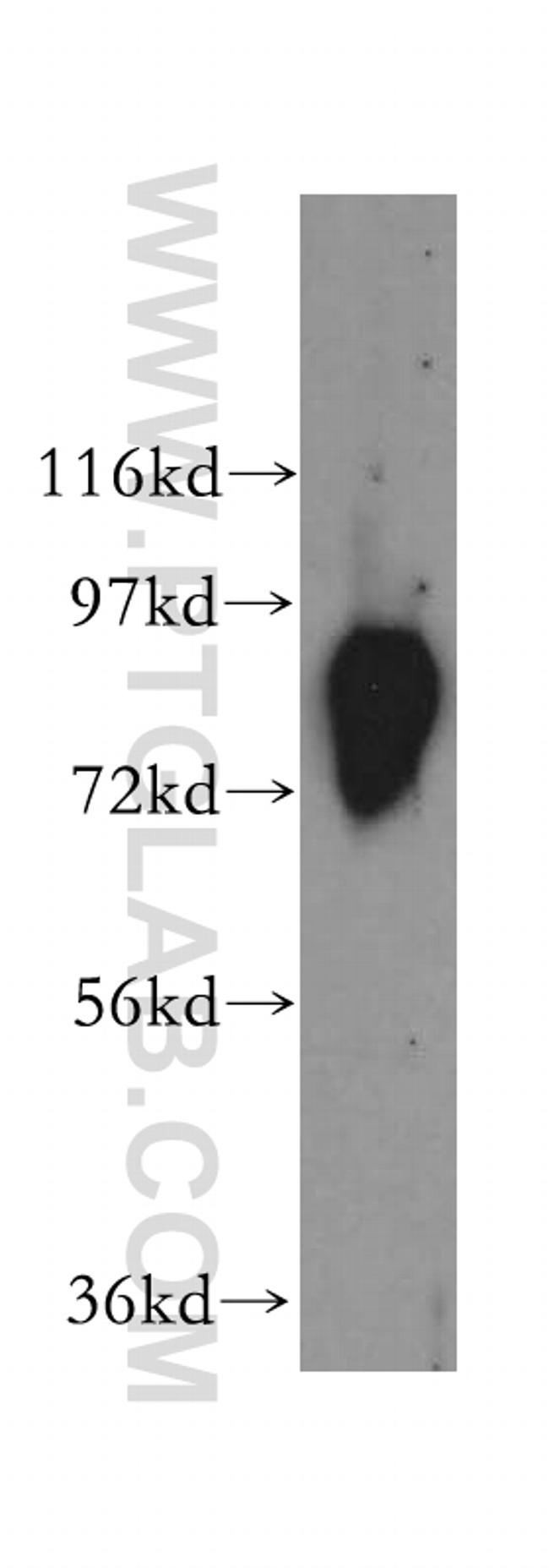 Aconitase 2 Antibody in Western Blot (WB)