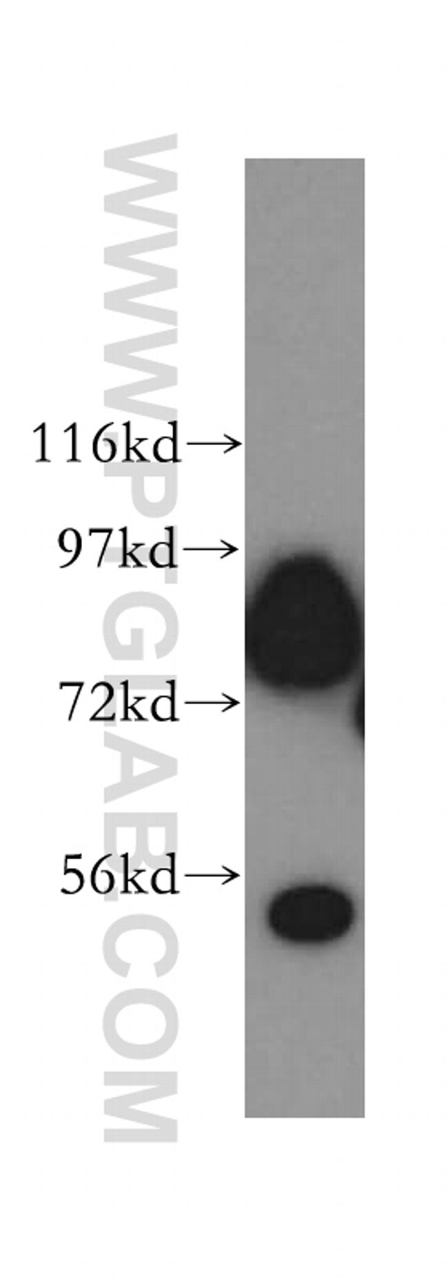 Aconitase 2 Antibody in Western Blot (WB)