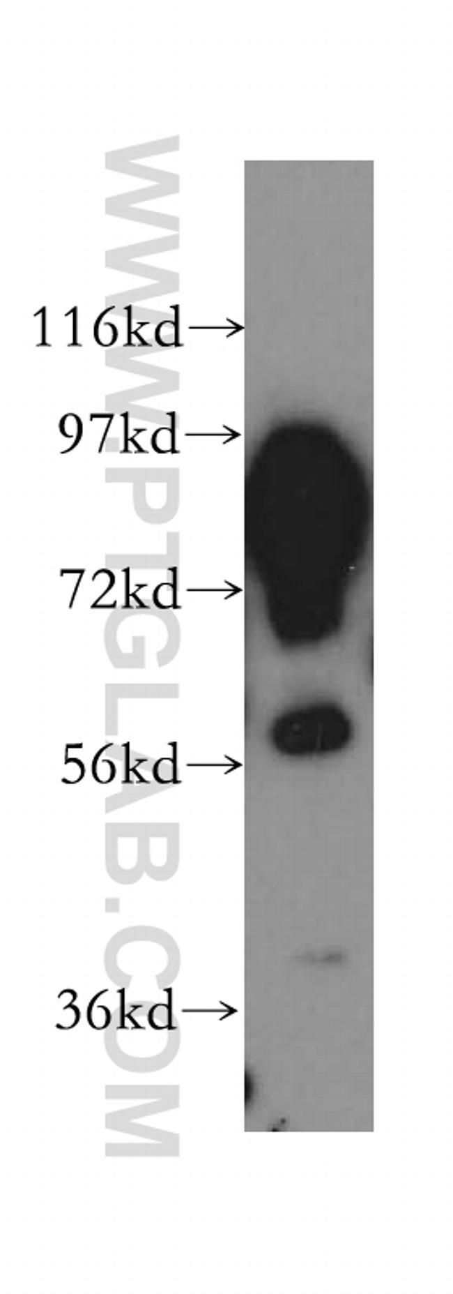 Aconitase 2 Antibody in Western Blot (WB)