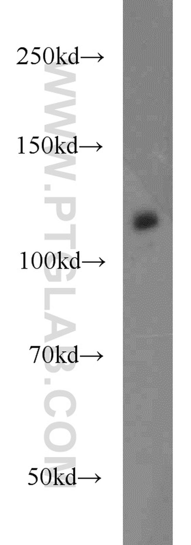 CNOT3 Antibody in Western Blot (WB)