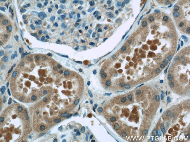 GNAI2 Antibody in Immunohistochemistry (Paraffin) (IHC (P))