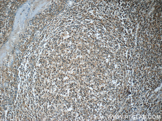 GNAI2 Antibody in Immunohistochemistry (Paraffin) (IHC (P))