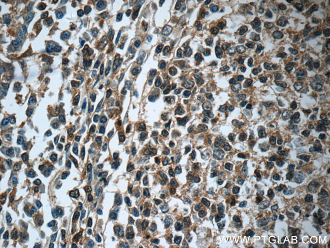 GNAI2 Antibody in Immunohistochemistry (Paraffin) (IHC (P))