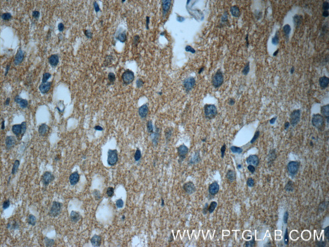 GNAI2 Antibody in Immunohistochemistry (Paraffin) (IHC (P))