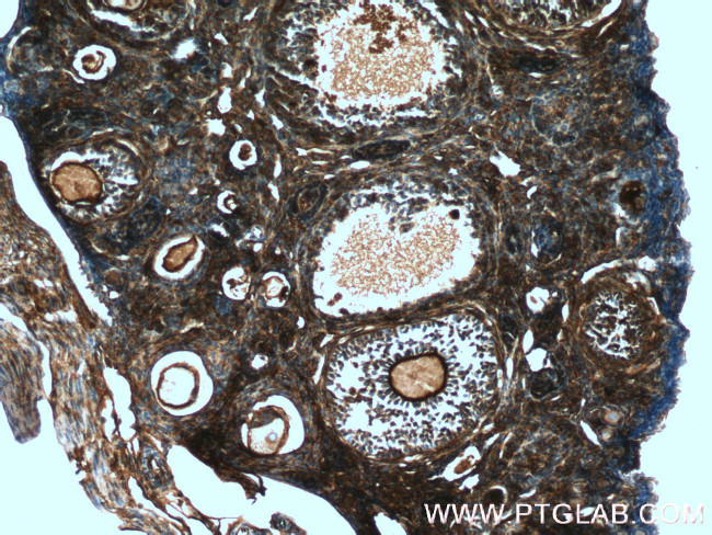 GNAI2 Antibody in Immunohistochemistry (Paraffin) (IHC (P))