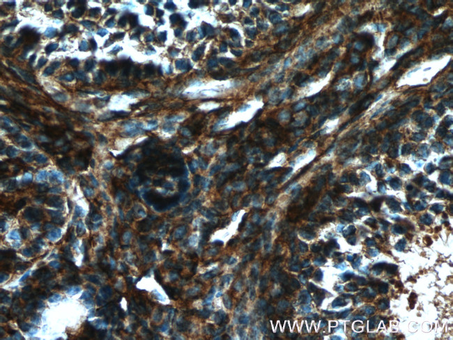 GNAI2 Antibody in Immunohistochemistry (Paraffin) (IHC (P))