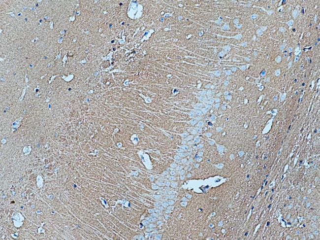 GNAI2 Antibody in Immunohistochemistry (Paraffin) (IHC (P))