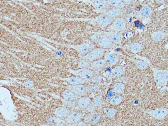 GNAI2 Antibody in Immunohistochemistry (Paraffin) (IHC (P))