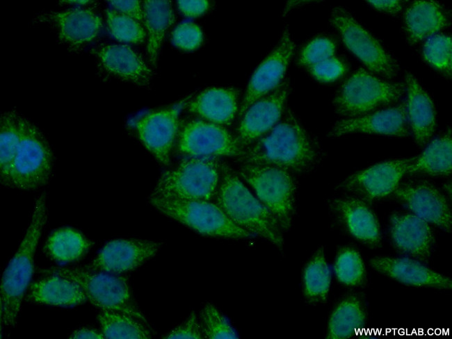 MMAB Antibody in Immunocytochemistry (ICC/IF)