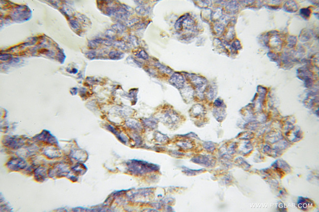 MMAB Antibody in Immunohistochemistry (Paraffin) (IHC (P))