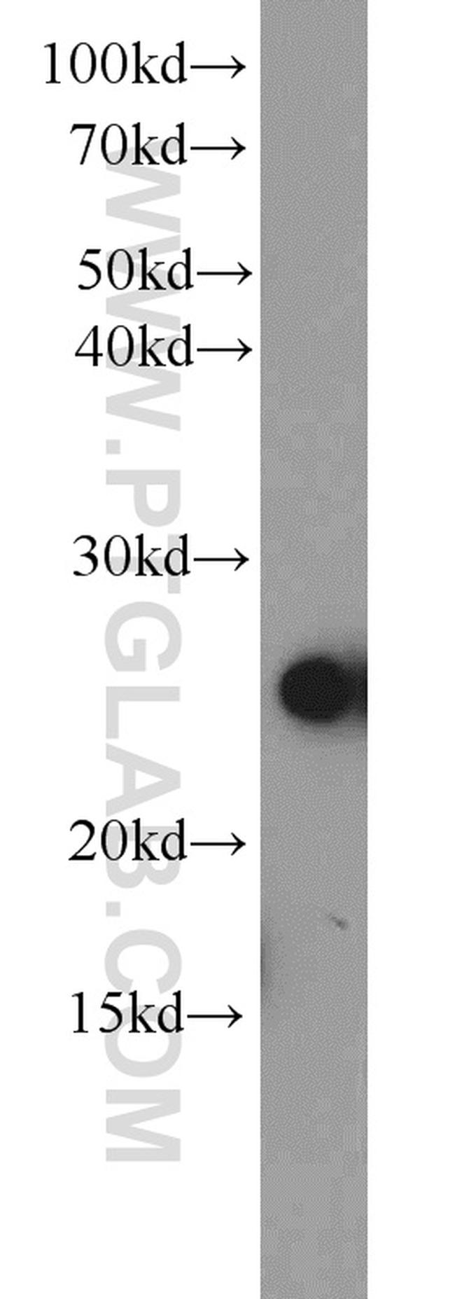 MMAB Antibody in Western Blot (WB)