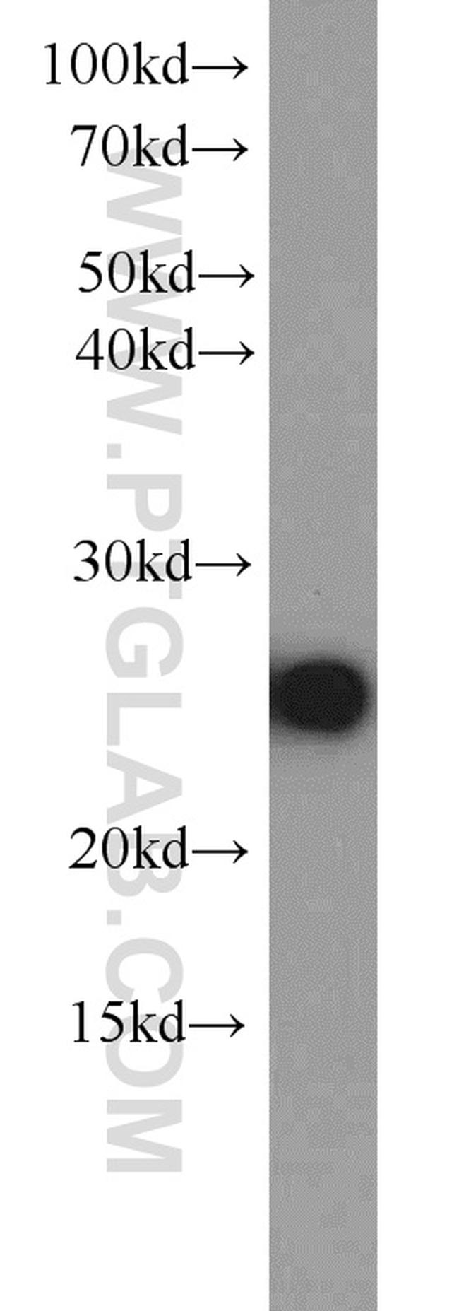 MMAB Antibody in Western Blot (WB)